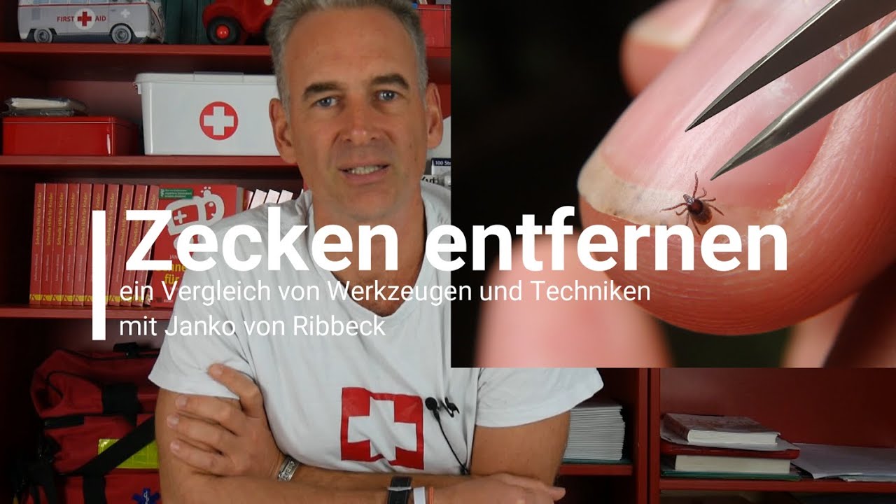 Hilfe, ich muss eine Zecke entfernen