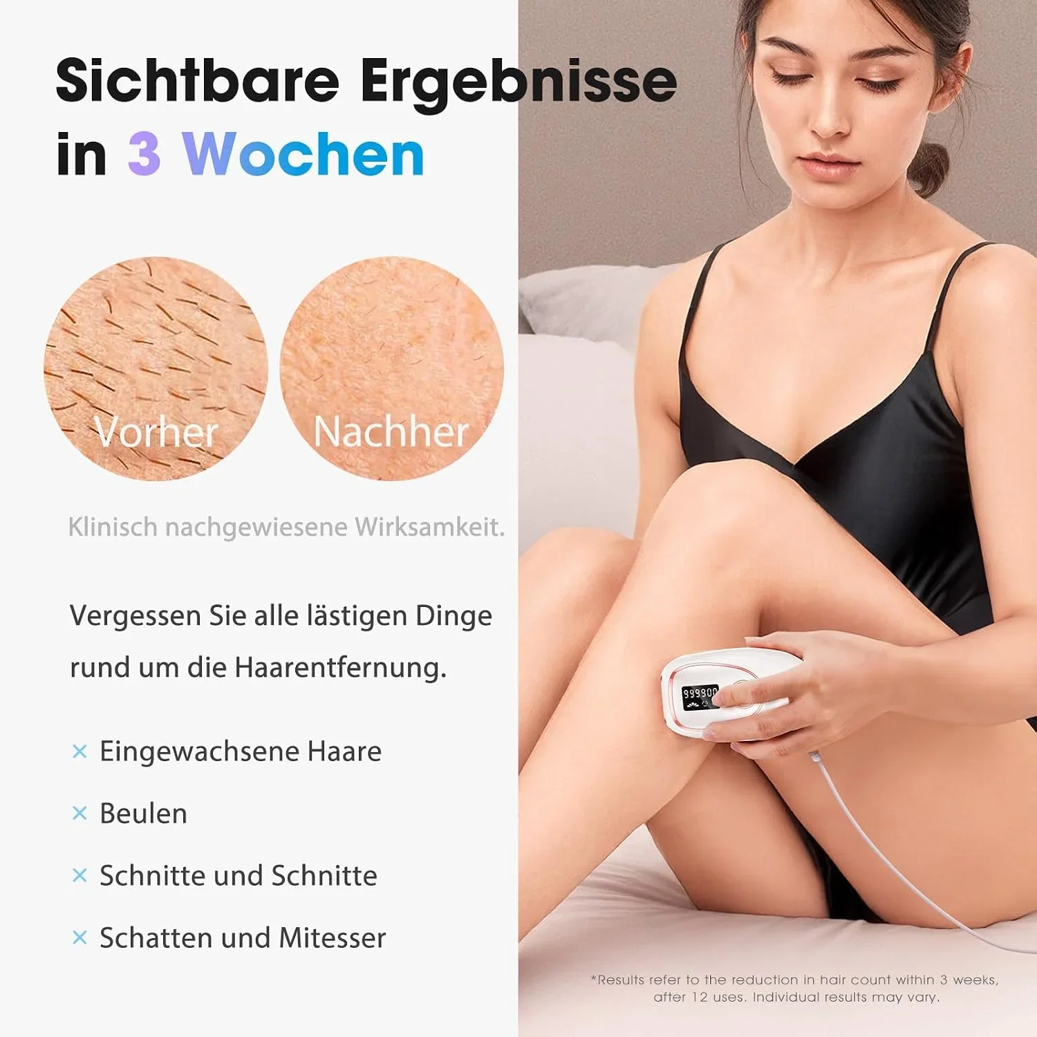 Haarlosy IPL Haarentfernungs Laser mit Kühlfunktion