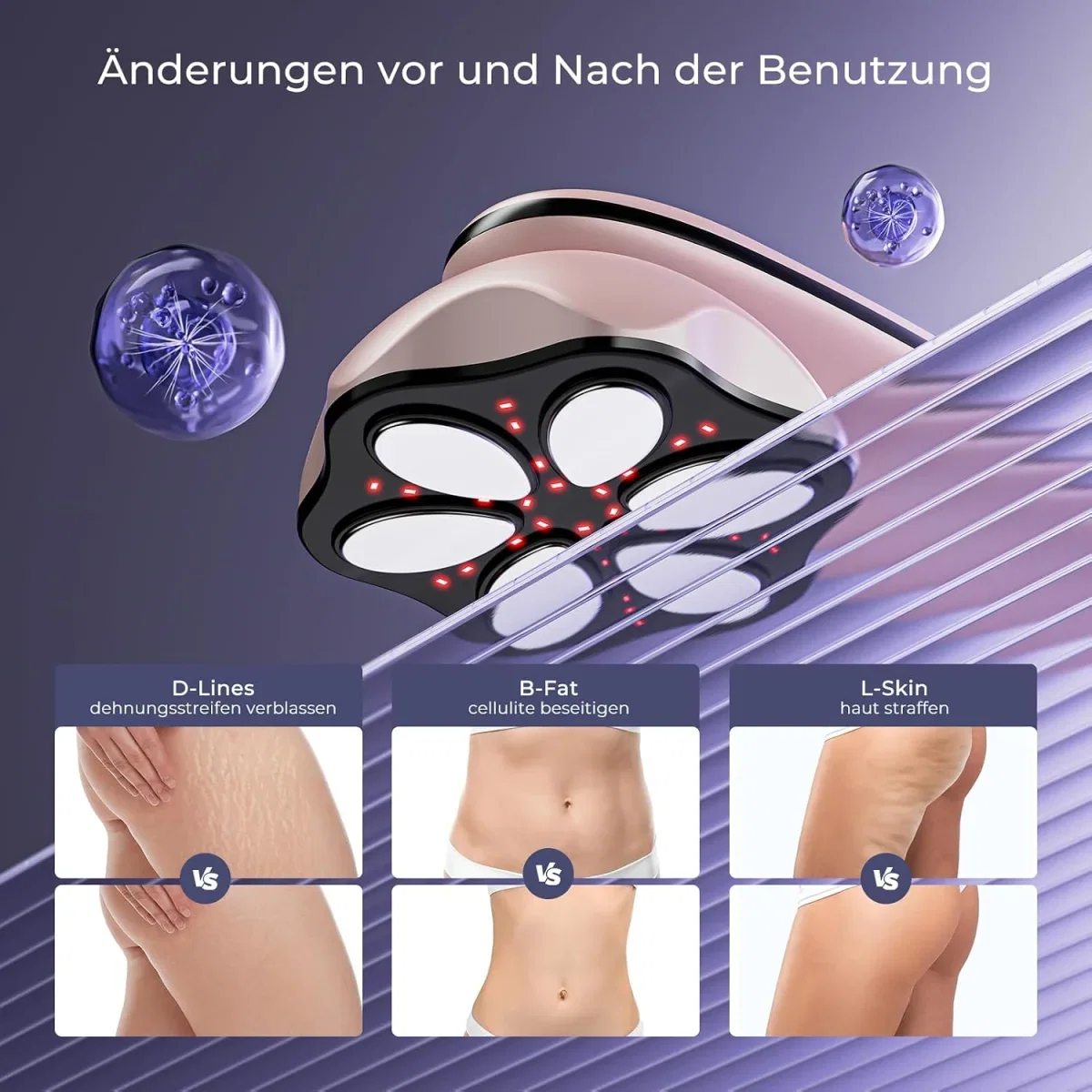 Oranmagic Cellulite Massagegerät