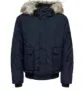 Only and Sons Jacke mit Kunstfell (Gr. S,L,XL,XXL) für 20,94 € inkl. Versand (statt 60,00 €)
