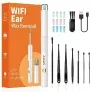 Xylla Ohrenschmalz Entferner Otoskop 1920P HD-Ear Wax Removal IP67 (2 Farben) für 9,89 € inkl. Prime-Versand (statt 14,99 €)